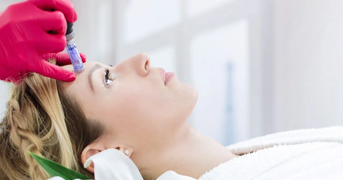 A woman receiving microneedling treatment on her forehead in Reno, NV