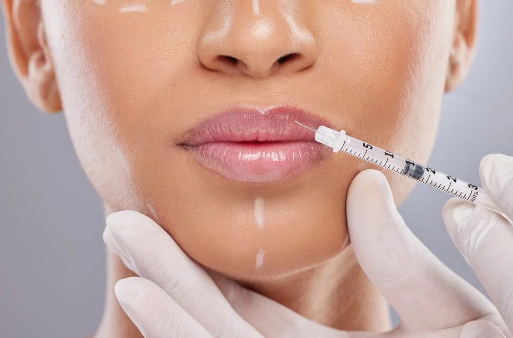 Dermal Fillers in Reno, NV at DURM Aesthetics and Wellness