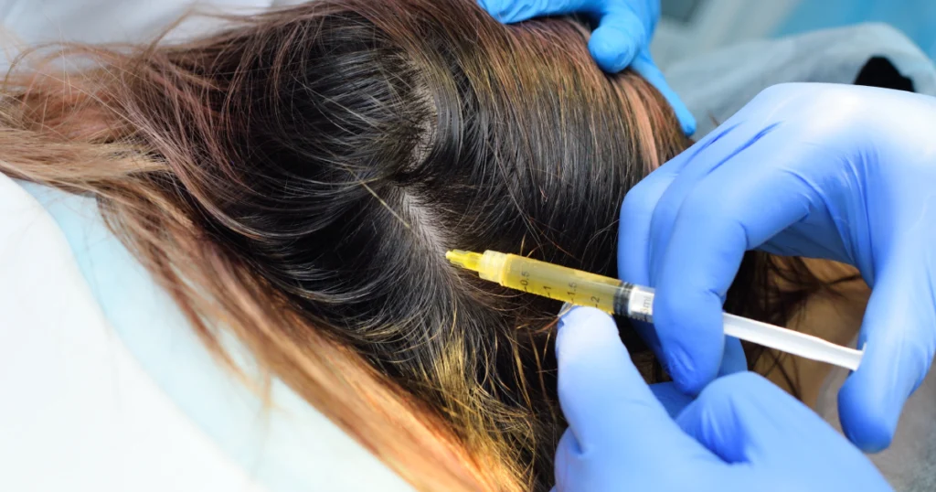 Women Receiving PRP hair restoration injection treatment in Reno, NV Clinic